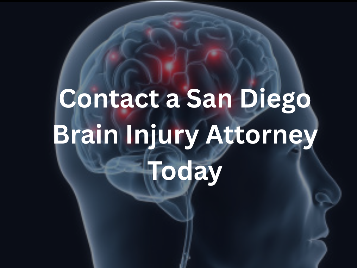 san-diego-brain-injury-lawyer